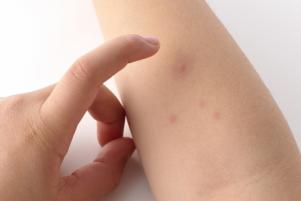 子どもの皮膚にぶつぶつ、湿疹がでている…原因は？