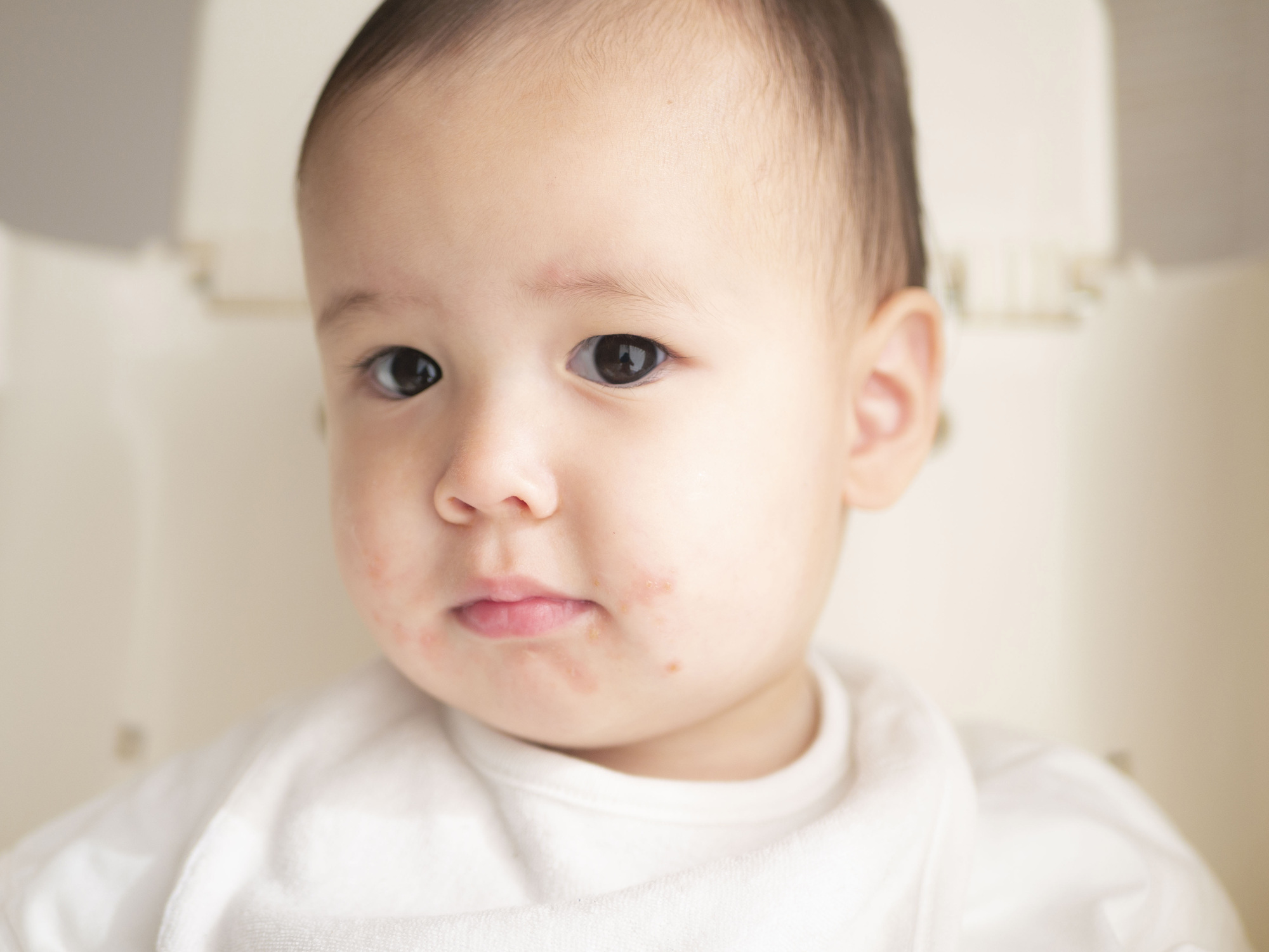 子どもも大人もうつる！？溶連菌感染症とは